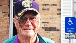 80-Year-Old Army Vet and Cancer Survivor, Mercilessly Beaten By Police Who “Feared For Their Lives”